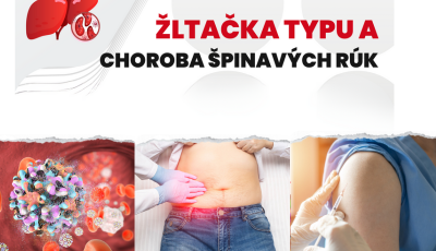 Výskyt žltačky typu A v meste Sabinov