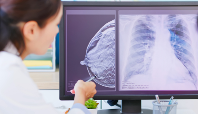 Prešovská nemocnica otvorila špičkové špecializované pracovisko zamerané na diagnostiku a liečbu ochorení prsníkov